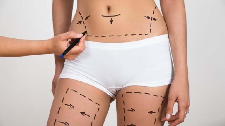 Doğum sonrası estetik dokunuş: Anne estetiği