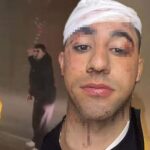 İstanbul’da Taksici Korkusu: “Sopayla Kafama On Defa Vurdu!”