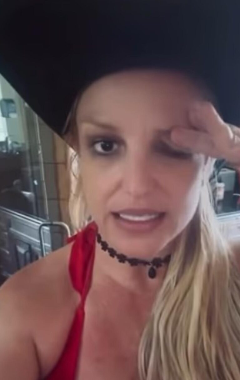 Britney Spears, hatalı botoks işlemi yaptırdığını açıkladı: Gözü haftalarca düşük kaldı